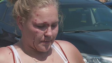 Woman shot, bloodied on I-10 in Metairie in apparent road rage incident