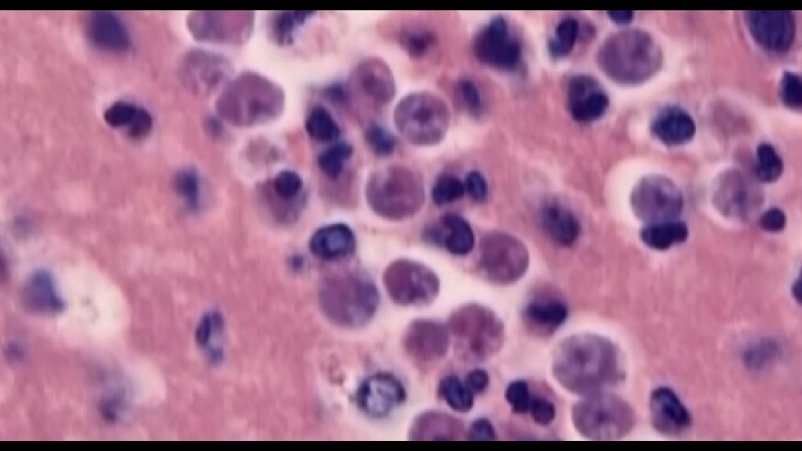 Brain-eating amoeba no longer in Terrebonne water system | wwltv.com