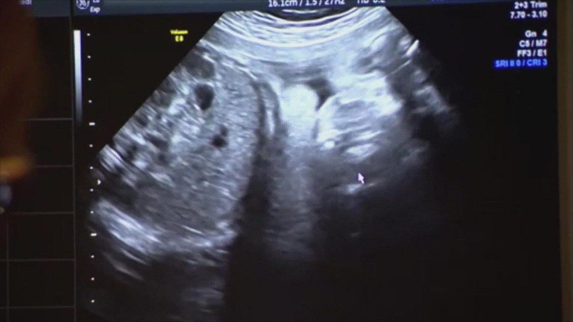 COVID vaccine does not harm unborn babies, new study shows