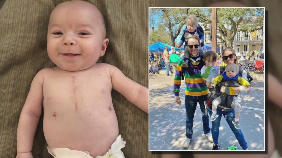 Child born with a hole in his heart thriving thanks to Mardi Gras miracle - Vimarsana News