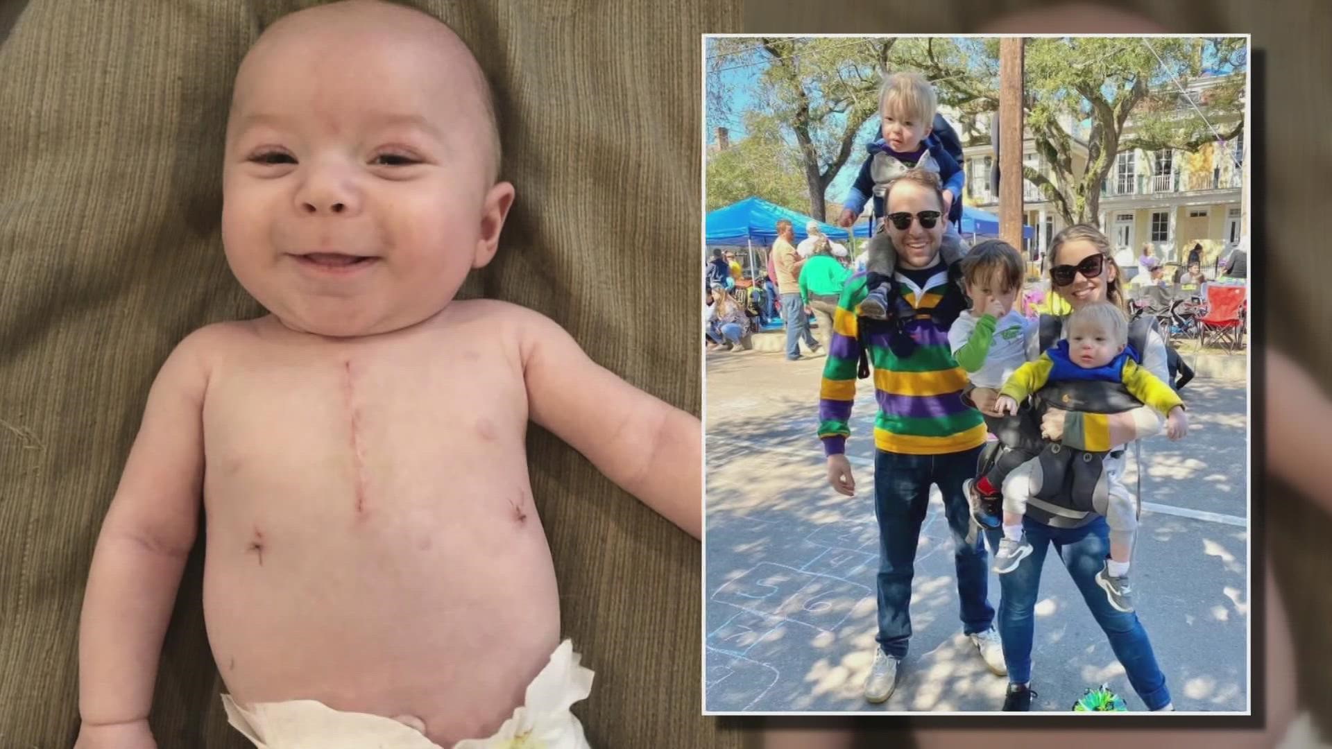 Child born with a hole in his heart thriving thanks to Mardi Gras ...