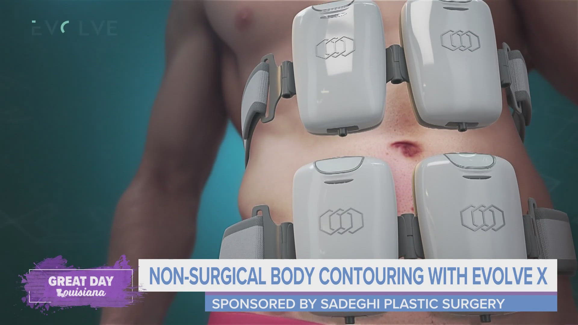 Dr. Ali Sadeghi shares how Evolve X can help contour your body without the use of surgery.