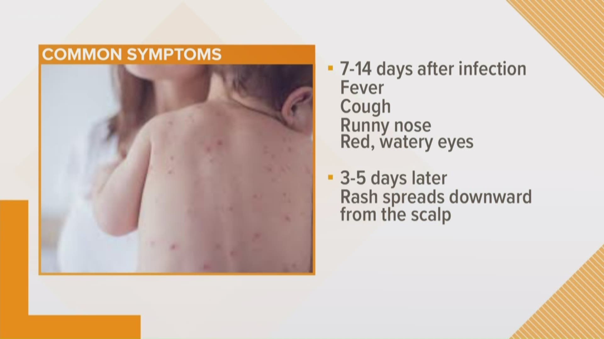 Dr. Michael Wasserman is breaking down the different stages and symptoms of the disease and what parents can do to protect their children from the fast spreading virus.