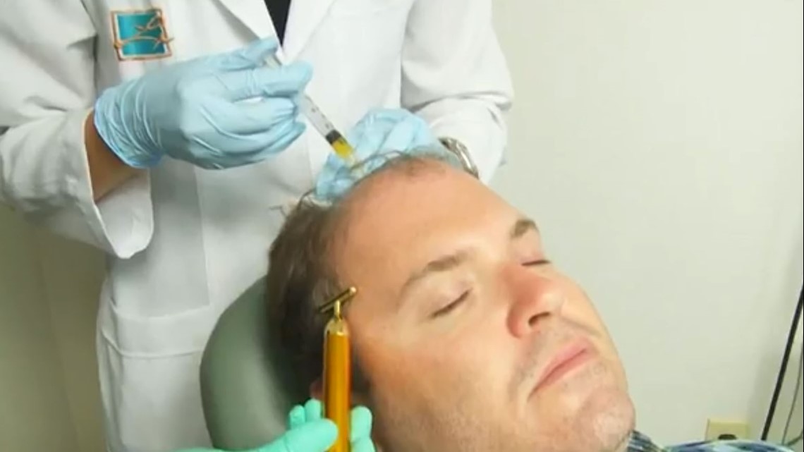 Treatment uses your own blood plasma to regrow hair