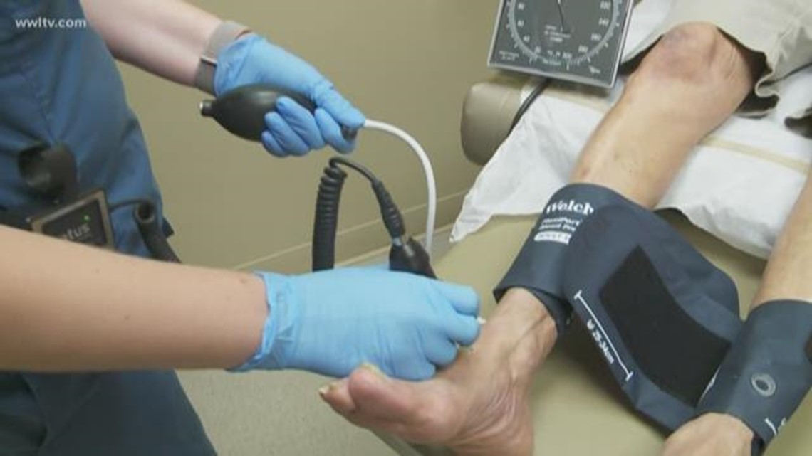 Do your legs hurt or cramp up after you walk? A free study at Ochsner