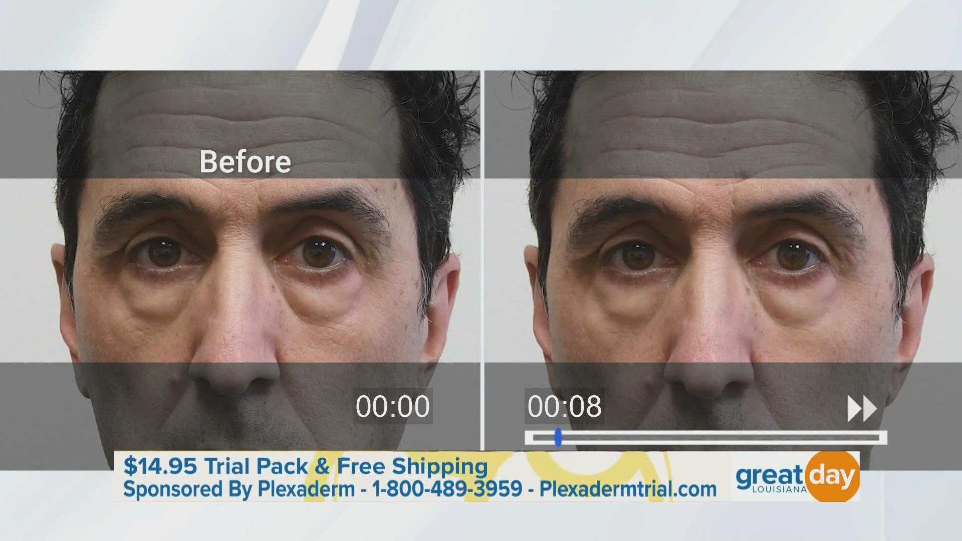 Plexaderm can help reduce the key signs of aging. Go to Plexadermtrial.com or call 1-800-489-5939 for your $14.95 trial pack + free shipping.