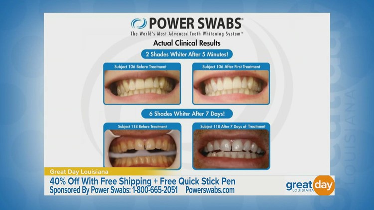 Power Swabs Offers A Whiter Smile In 5 Minutes