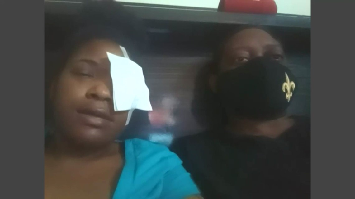 IHOP employee shot in head, shares what she remembers ...