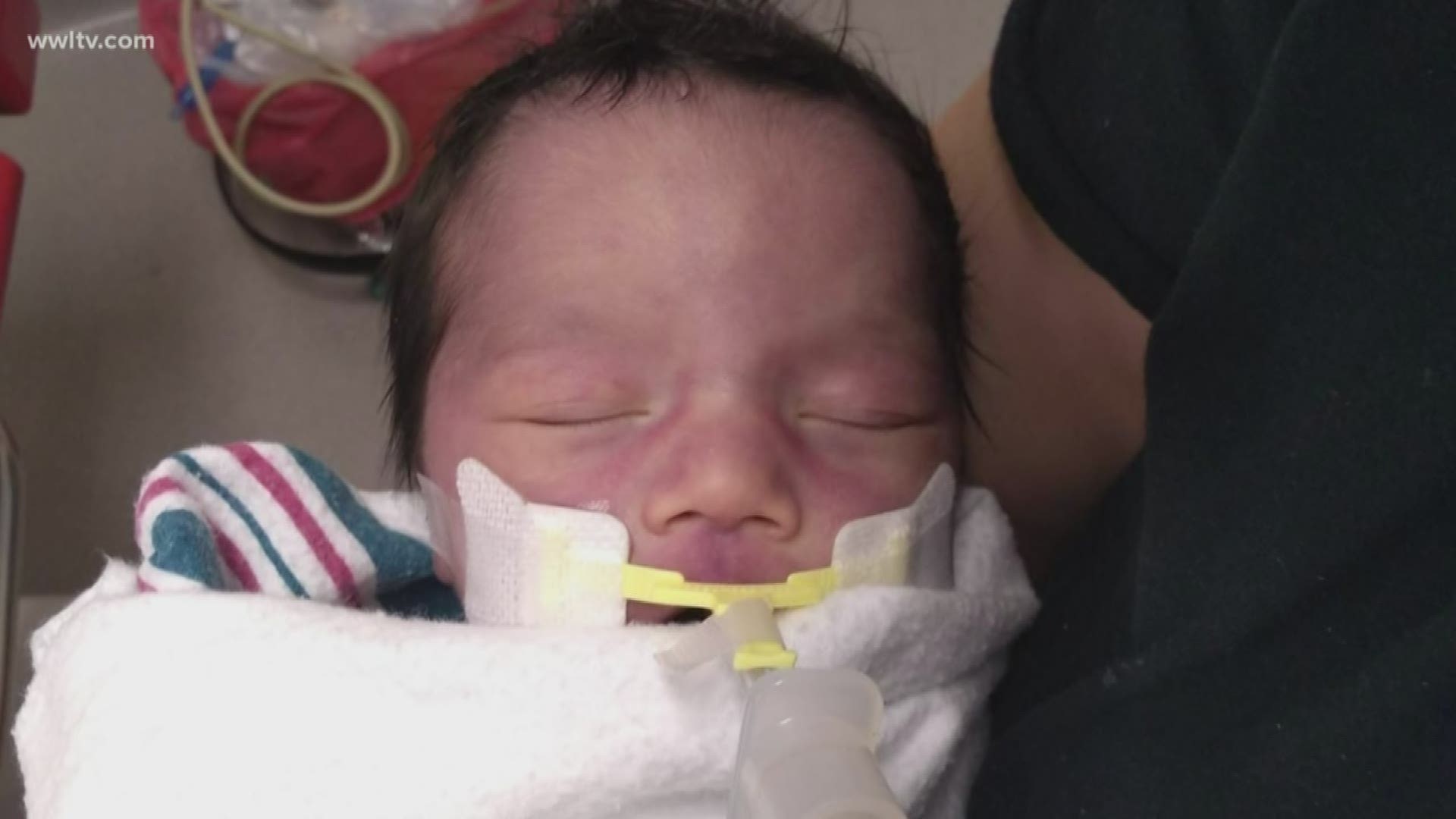 After surviving firework accident in the womb, 4dayold baby dies in