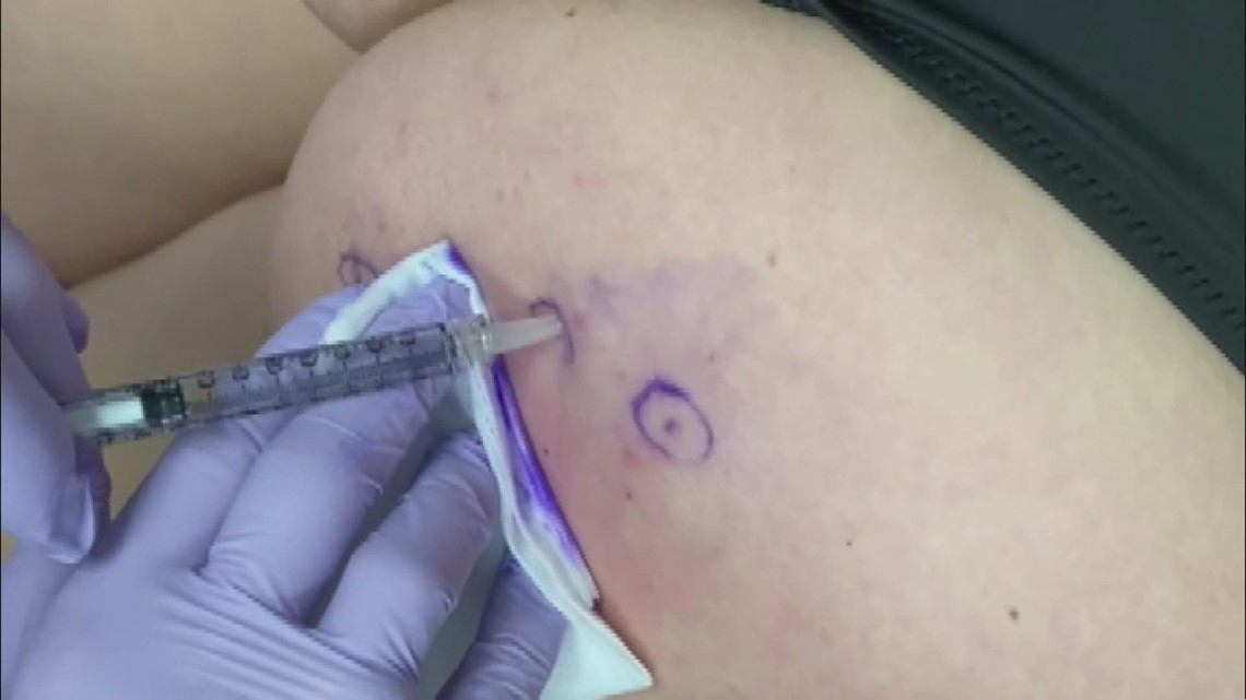 Injection shows promise of getting rid of cellulite in 10 weeks - Vimarsana News