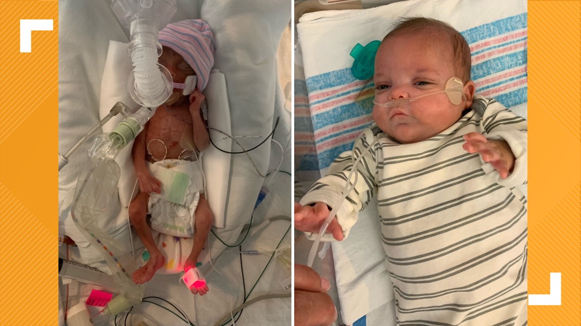 ‘Miracle baby’ born at 22 weeks breaks hospital record
