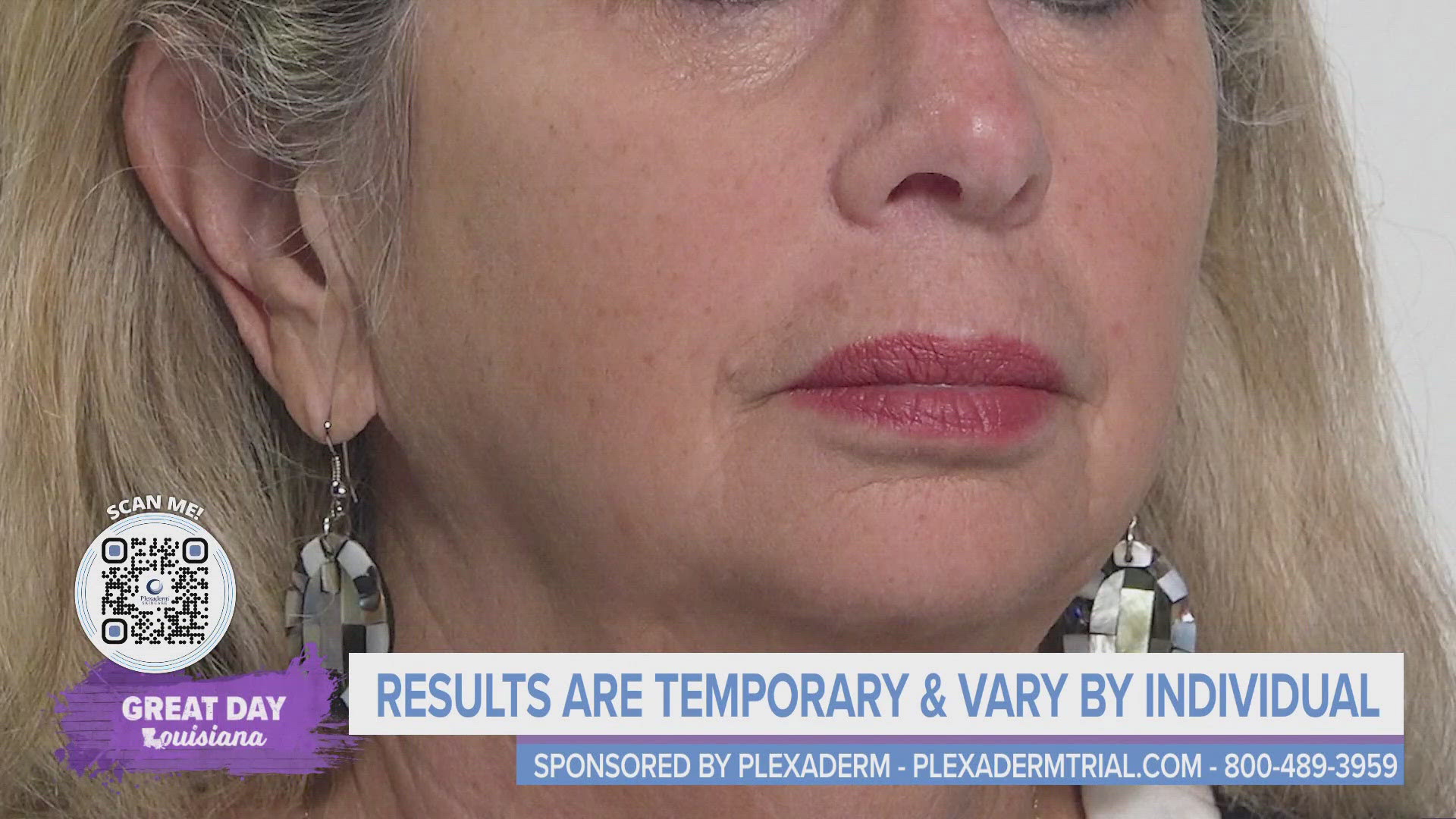 Annette Figueroa shares how Plexaderm can help fight the signs of aging.